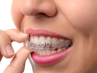 An adult female with a clear retainer, holding her finger against her teeth, possibly inspecting her oral appliance.