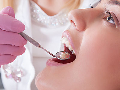 Woman receiving dental care with open mouth and dental tools being used by dental professional.